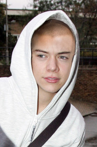 Harry Styles with no hair and a hood on 