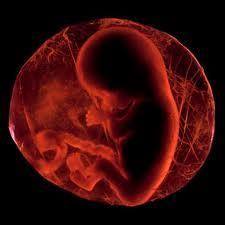  Jayla's & Michael's unborn child at 5weeks