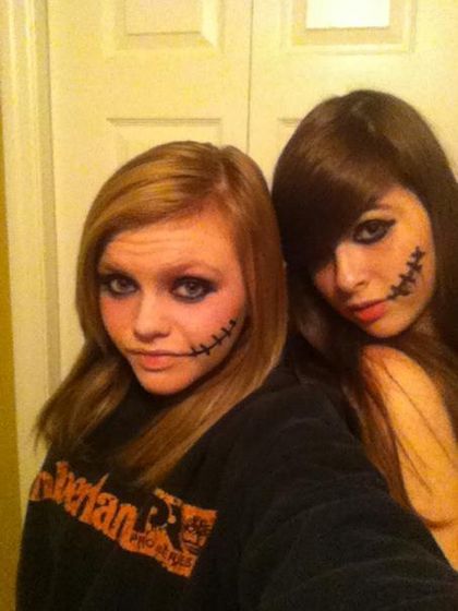  Kylie And Me montrer Off Our Scars :D