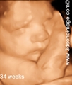 3D Ultrasound Abbotsford - video-sharing photo