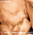 3D Ultrasound Vancouver - video-sharing photo