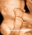 3D Ultrasound - video-sharing photo