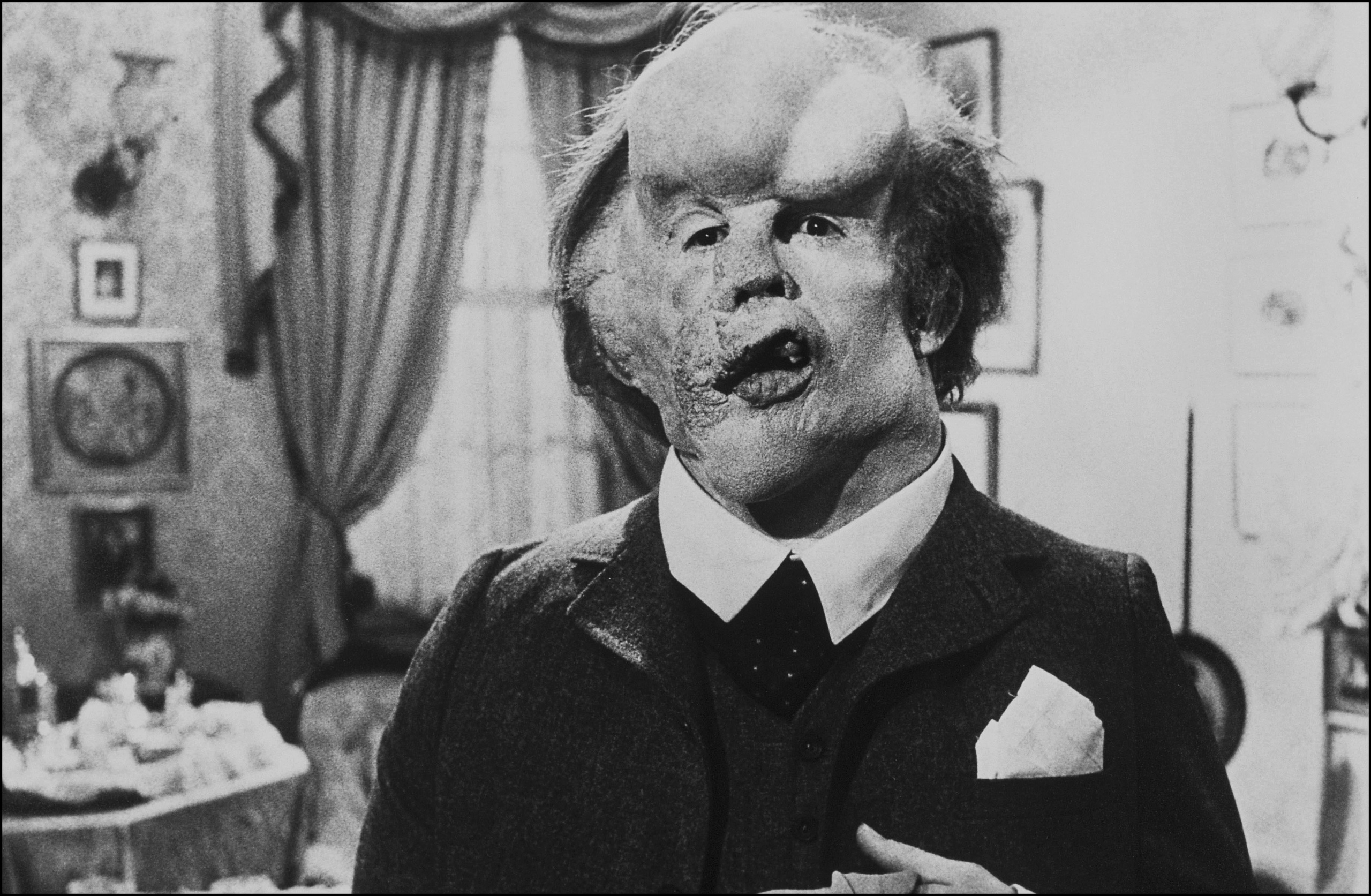 Image result for the elephant man
