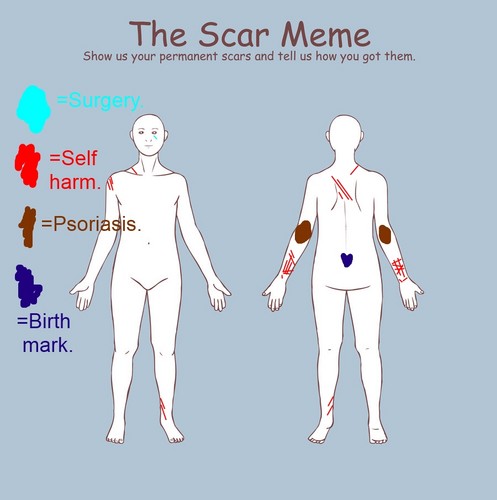  Mephy's scar meme.