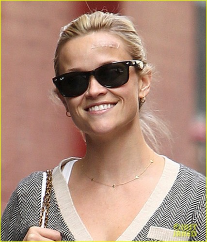 Reese Witherspoon: Bandaged Forehead!