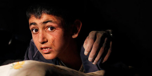  Yunus Geray, a 13-year-old survivor of the earthquake