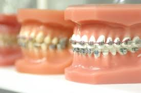 Orthodontist: Know The Traits That Comfort Young Patients