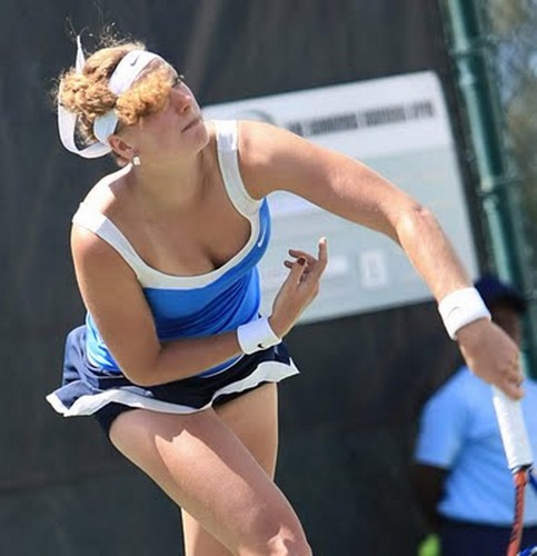  Petra Kvitova showed breast