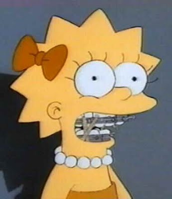 lisa with braces