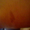 My moms heart shaped birthmark :3 Thirddevision photo