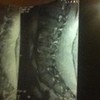 my spine Clutch13 photo